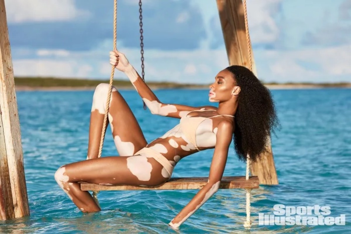 Winnie Harlow